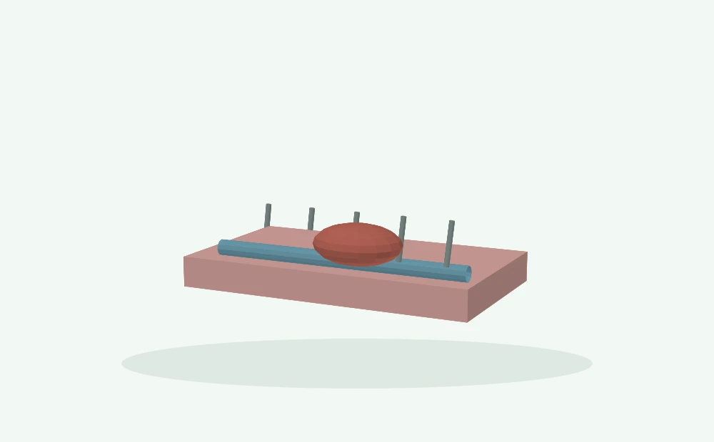 Modelo 3D esquemático: Punção venosa, compressão e hematoma