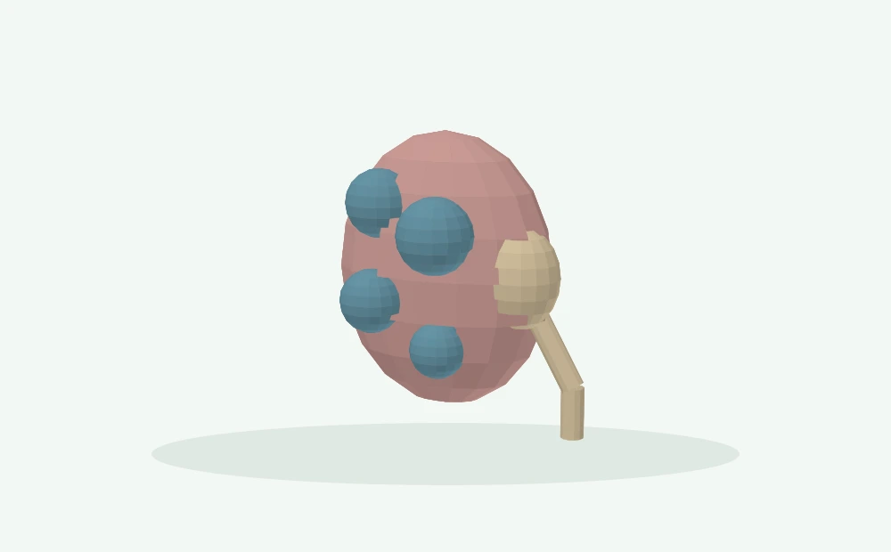 Modelo 3D esquemático: Rim, cistos e rastreamento de doença hereditária
